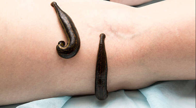 istockphoto-585493194-612x612 (1)