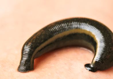 suluk-tedavisi-q7ij9i5n6zx2physk9t84p789ur3525muqmtapb4zk